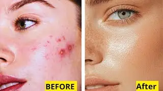 Glow Naturally DIY Face Mask and Toner for Radiant Skin!