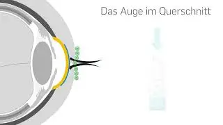 ocuvers sprays
