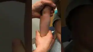 Could you fix this child&rsquo;s arm?