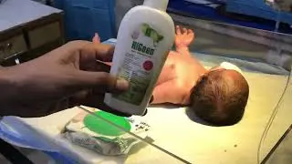 👶 Baby with Abdominal Distension | Glycerin Suppository for Relief 🍼