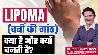 Lipoma (चर्बी की गांठ) क्या है और क्यों बनती हैं? | Lipoma Treatment Options & Recovery Tips