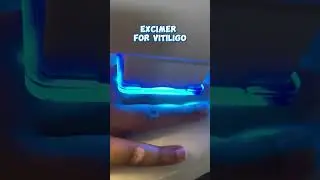 form of modality for the treatment of Vitiligo. #VitiligoTreatment #ExcimerLaser #SkincareTechnology