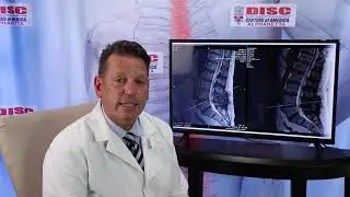 Healing Beyond Surgery: A Herniated Disc Success Story