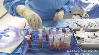 Micro Fat Grafting Preparation