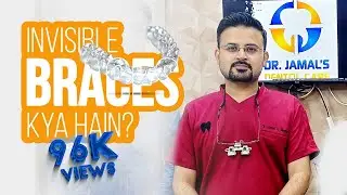 Invisible braces kya hen? | Bagair taar lagaye ghar bethe dant seedhe karaein | Clear Aligners