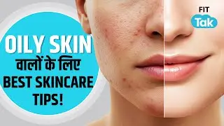 5 Monsoon Skincare MISTAKES Ruining Your Oily Skin | Oily Skincare Routine For Men & Women
