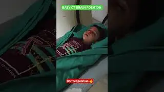BABY CORRECT PLANNING IN BRAIN CT.. FULL VIDEO COMMING SOON.. #pediatic #ctscan #radiology #tech