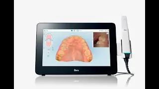 Scanner intra-oral iTero lumina