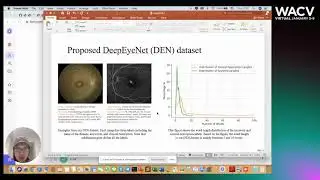 33 - DeepOpht: Medical Report Generation for Retinal Images via Deep Models and Visual Explanation