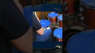 V&iacute;deo COMPLETO aqui no canal &bull; Pele Williams Density Coated WCU2