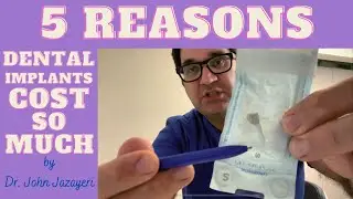 Why Are Dental Implants Sooo Expensive?