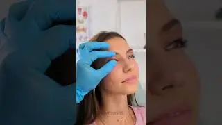 Yes, this is how they do it! Amazing medical procedures 👨&zwj;⚕