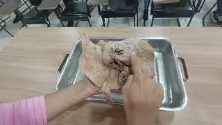 Liver: relations & ligaments