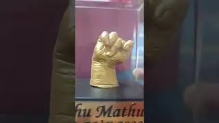 Pihu ka Hand Cast ✊ And full Information || #shorts #handcasting