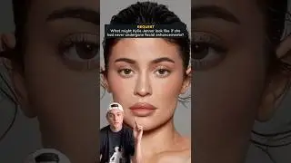 What if Kylie Jenner never underwent facial Enhancements? #kyliejenner