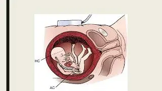 Assessment of High Risk Pregnancy