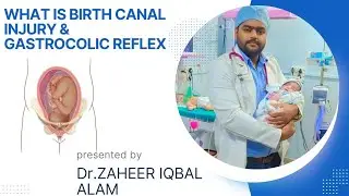 WHAT IS BIRTH CANAL INJURIES AND GASTROCOLIC REFLEX IN NEWBORN BABY