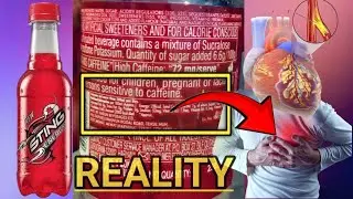 Sting Peene Se Kya Hota Hai Nuksan। Side Effects Of Sting Energy Drink॥ Barud Research॥