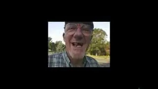 Menomonie Dentist - Amazing and Funny Before-and-After Case