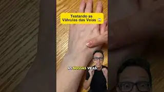 V&aacute;lvulas das Veias 😱#medicina #medico #enfermagem #enfermeiro #enfermeira #anatomia #anatomiahumana