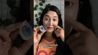 Removing My Blackheads with Vaseline⁉️😱🤯