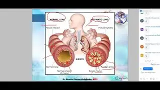 Asthma البورد الأمريكى للصيادلة
