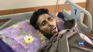 نړۍ کې د تور زیړي پر ضد د مبارزې نړیواله ورځ