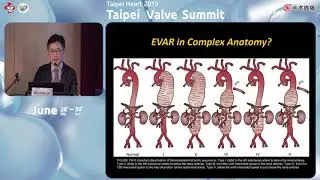 Taipei Valve Summit 2019 06 30