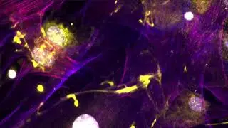 JID September 2024 Cover - Subcutaneous fibroblasts spreading for 4 days on tissue culture plastic
