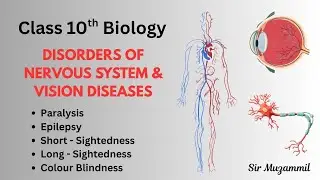 Class 10th Biology | Disorders of Nervous System & Vision Diseases (Chapter 3) | Sir Muzammil #bio