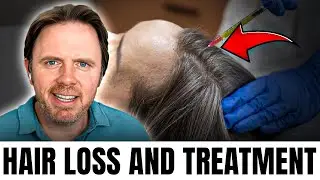 Struggling With Hair Loss? Do THIS for Regrowth & Thick Hair!