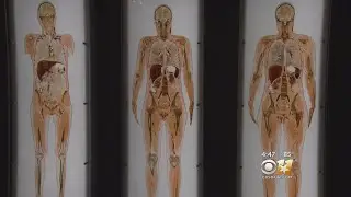 'Being Human' Exhibit Returns To Perot Museum