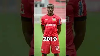 Moussa Diaby Evolution 👀 #shorts
