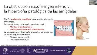 De la respiración oral al adulto disfuncional