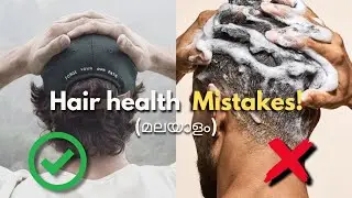 7 Common Hair Health Mistakes| Healthy Hair Tips for Men [മലയാളം]