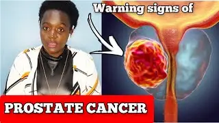 THE EARLY WARNING SIGNS OF PROSTATE CANCER..//Dorah H E
