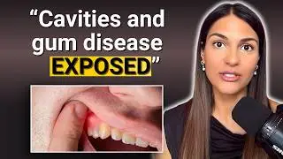 The REAL Reason Cavities and Gum Disease Are SO Common