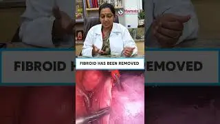 How We Perform Laparoscopic Myomectomy Using 3D Technology | Mamata Fertility Hospital: Hyderabad