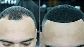 HOW TO COVER UP BALD SPOTS