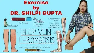 Dr shilpi gupta, 5 Best Exercises for Deep vein thrombosis & prevention