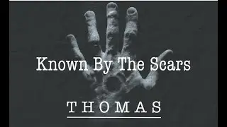 Known By the Scars - Sunday April 7, 2024