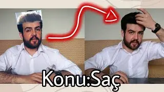 Saçlarımı Nasıl Kurtardım?