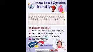 ⁉️ Image Based Question #norcet #aiims #kgmu #gmch #sgpgi #heart #tachycardia #cardiology #nursing