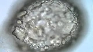 Rotifer eggs inside Netzelia test