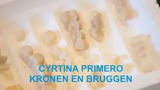 CYRTINA Primero Digitale Kronen en bruggen