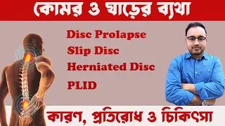 Back and Neck Pain | Disc Prolapse | Slip Disc | Herniated Disc | PLID Causes, Prevention and Tre...