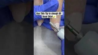 Effective technique to quickly exfoliate dead skin while doing a manicure! #shorts #deadskinremoval