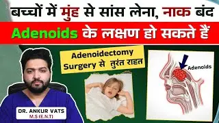Why Kids Sleep with Mouth Open | Adenoids Causes & Treatment