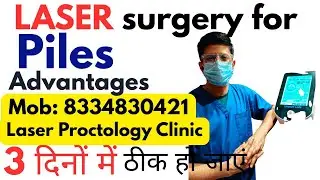 Laser surgery for piles | cost, recovery time | Laser treatment for piles