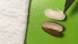 Seed Dissection